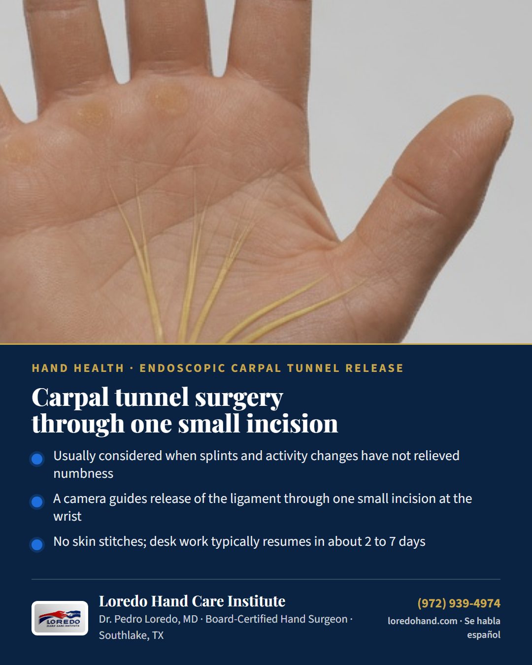 Carpal tunnel surgery through one small incision Loredo Hand Care Institute patient education card