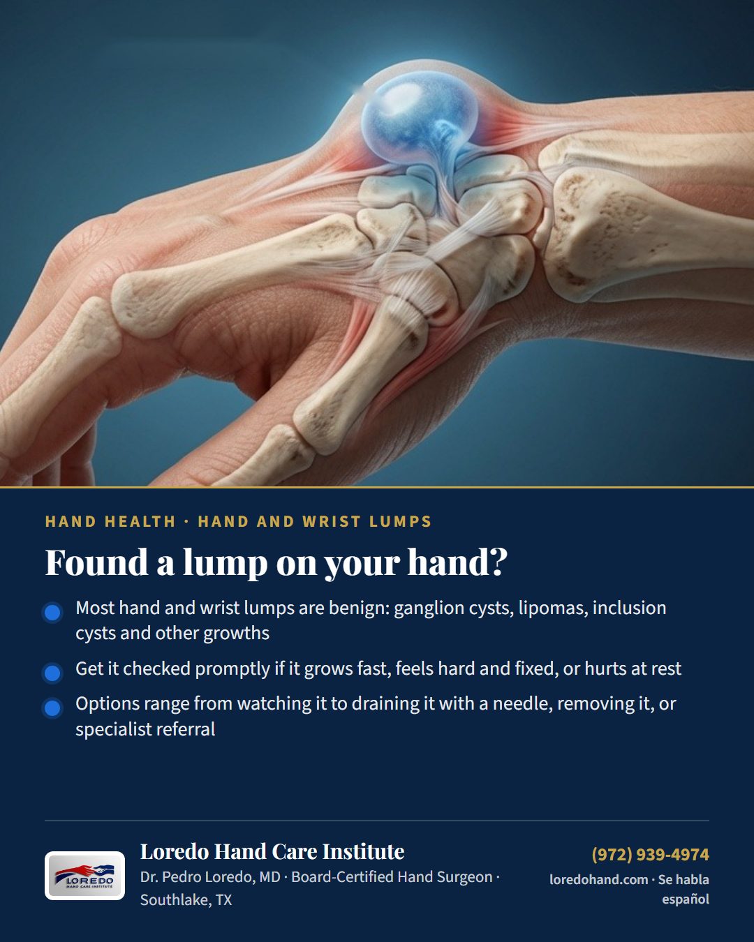 Found a lump on your hand? Loredo Hand Care Institute patient education card