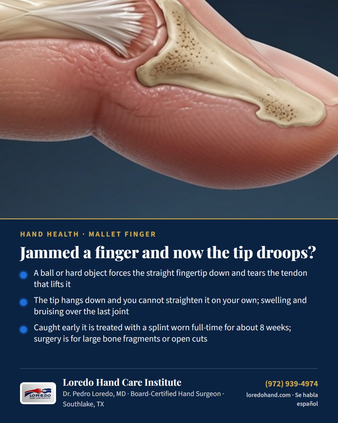 Jammed a finger and now the tip droops? Loredo Hand Care Institute patient education card