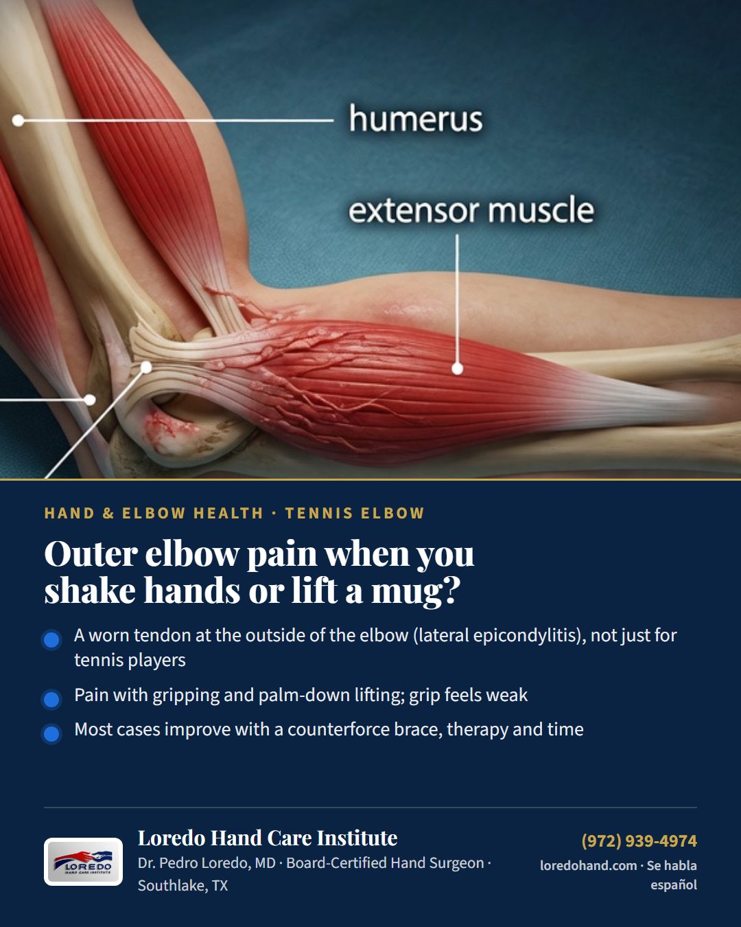 Outer elbow pain when you shake hands or lift a mug? Loredo Hand Care Institute patient education card